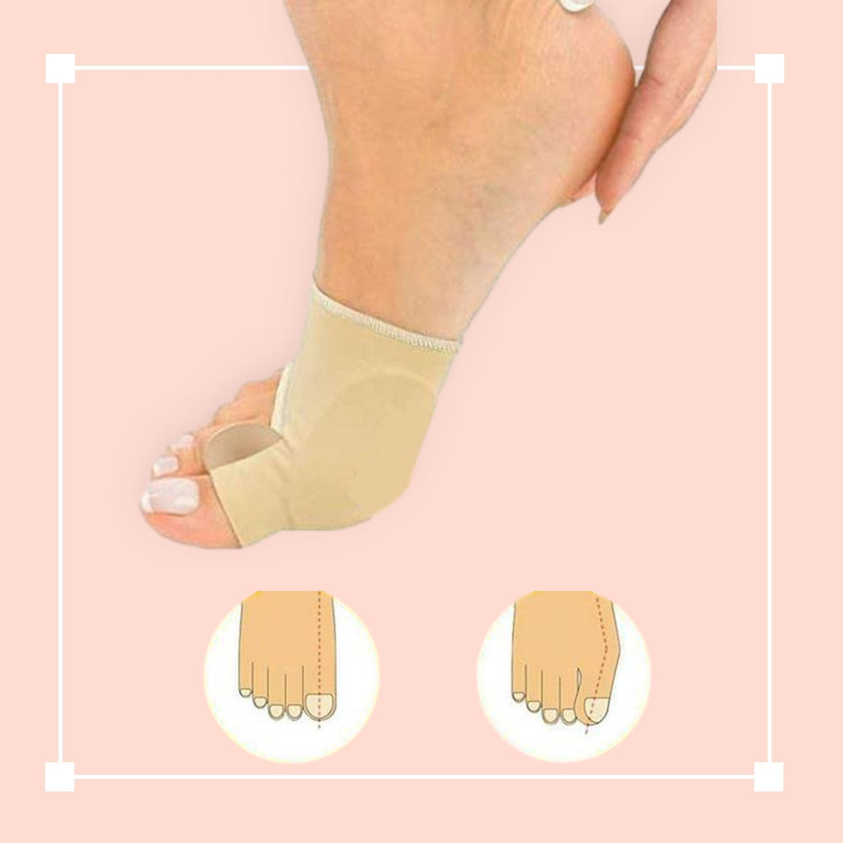 Teenspreidersleeve voor Hallux Valgus - Siliconen Teencorrector - Zachte Gelvoering - Eelt & Druk Preventie | Sansoti