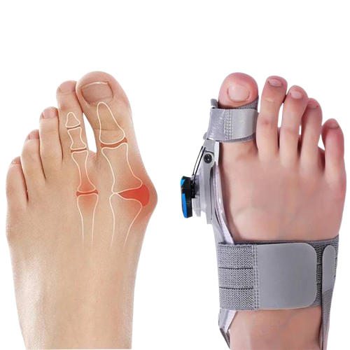 Toe Corrector with Adjustable Pressure for Hallux Valgus Treatment During the Day and at Night Comfortable Orthopedic | Sansoti