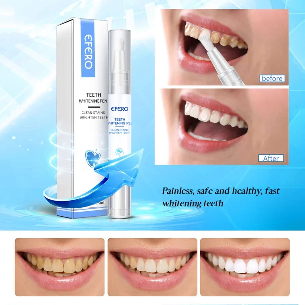 Teeth Whitening Pen with Precision Brush for Whiter Teeth on the Go, Dental Care, Stain Removal, Travel Size | Sansoti