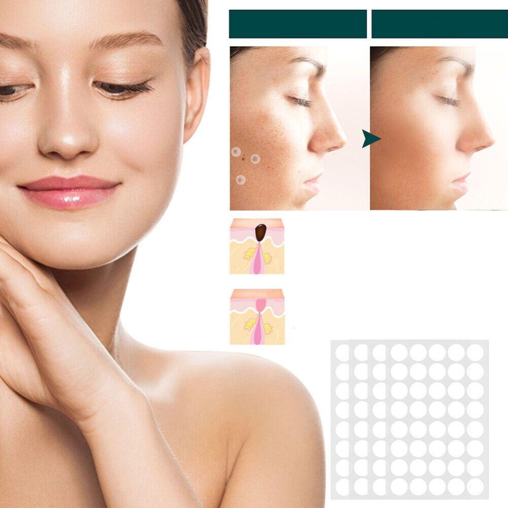 Patches de soins cutanés contre les imperfections, traitement et élimination des verrues à domicile, embellissement et soin de la peau | Sansoti