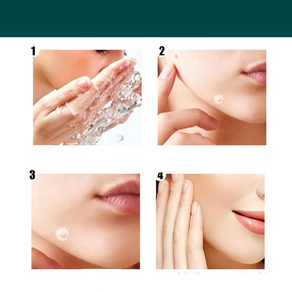 Patches de soins cutanés contre les imperfections, traitement et élimination des verrues à domicile, embellissement et soin de la peau | Sansoti